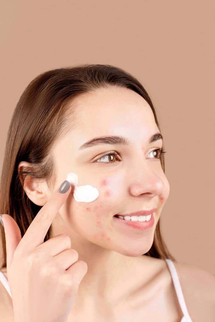 tretinoin-purge-timeline.jpg Tretinoin purge timeline showing tretinoin side effects from weeks 1 to 12